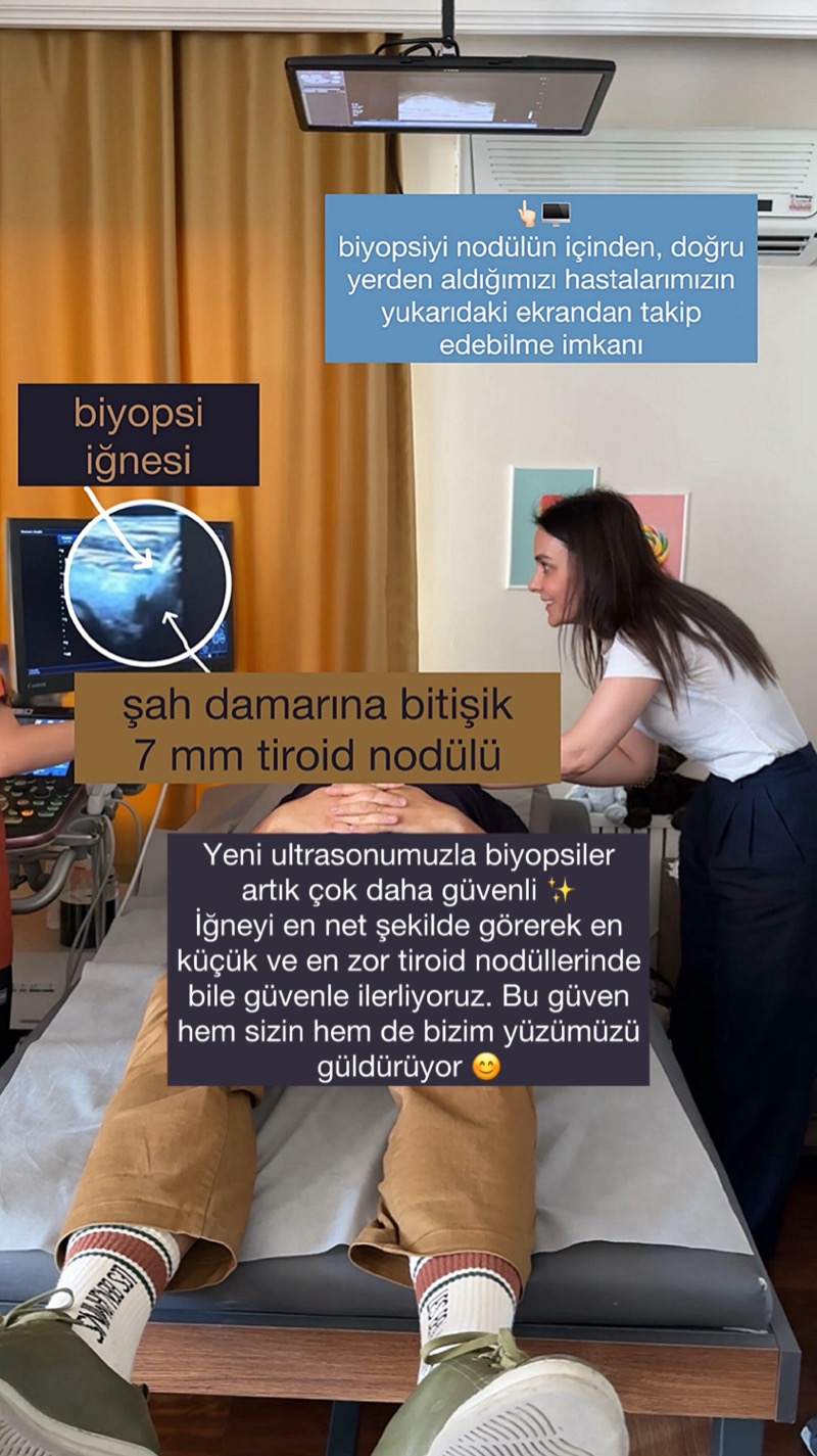 Ultrason eşliğinde tiroid biyopsisi işlemi