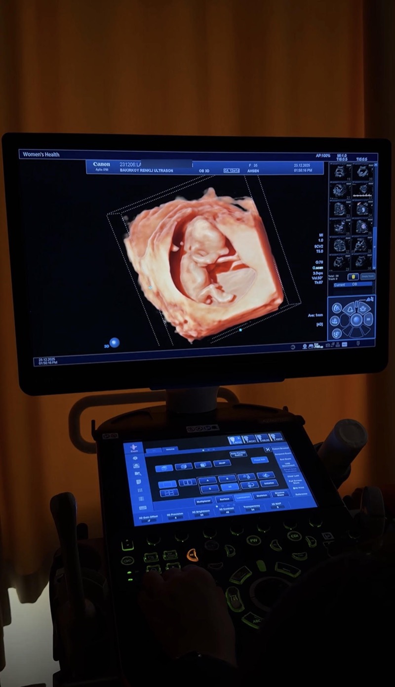 İlk trimester tarama (ikili test) sırasında üç boyutlu fetal görüntü