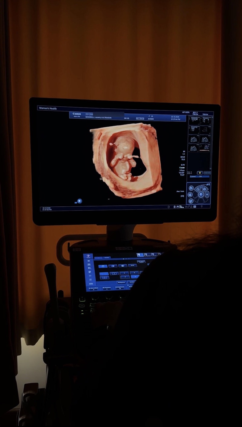 İkinci trimester tarama sırasında fetal görüntüleme