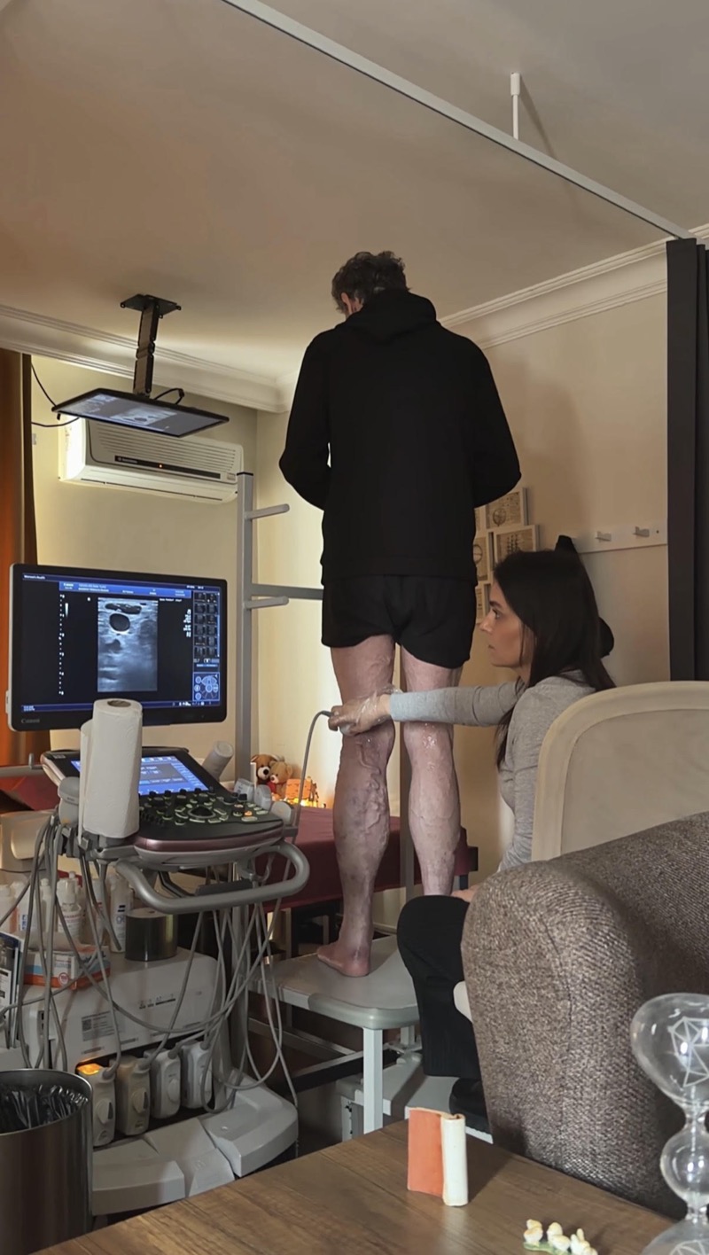 Ayakta yapılan alt ekstremite venöz Doppler (varis) incelemesi